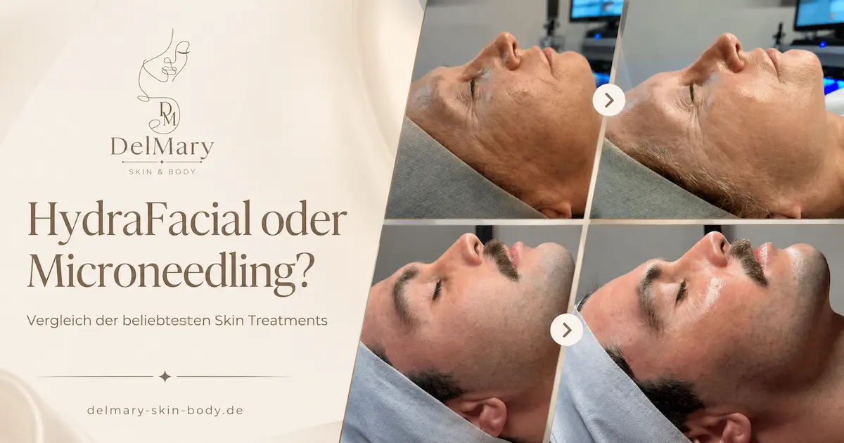 hydrafacial oder microneedling
